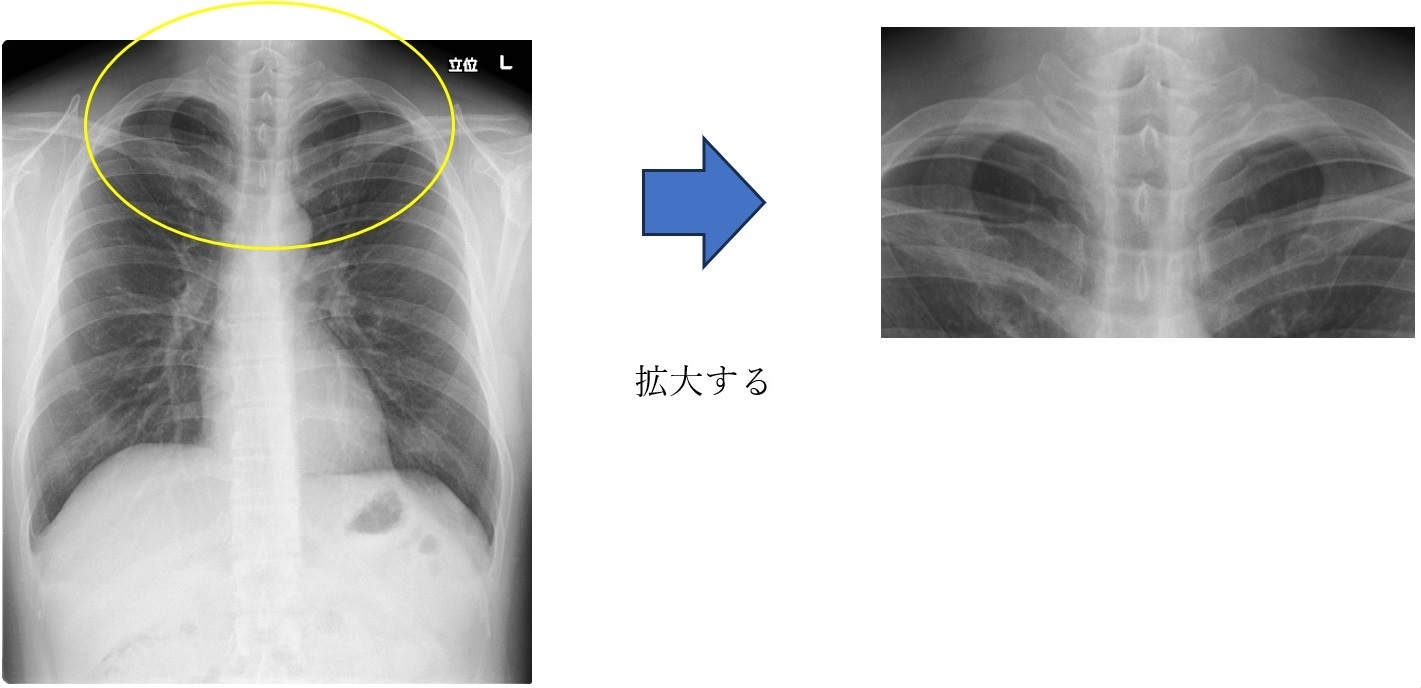 CR拡大の写真